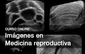 Curso imágenes en medicina reproductiva